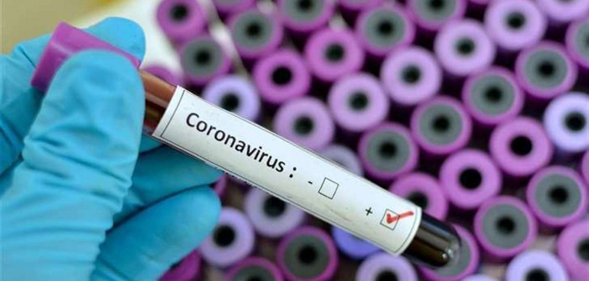 Koronavirus test